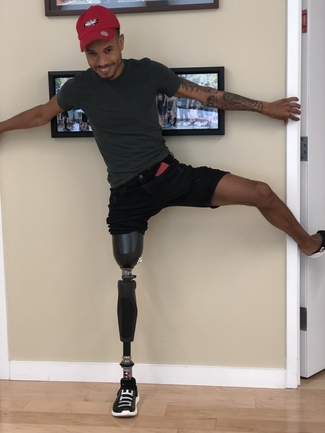 above the knee prosthetic leg